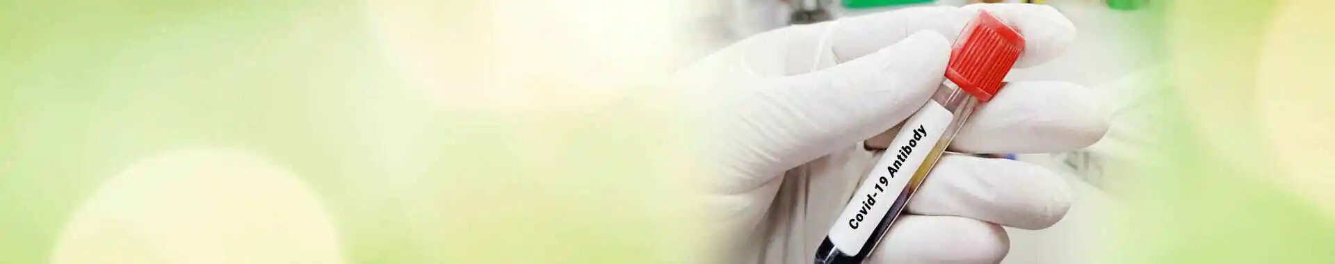 Количественный тест на антитела IgG к спайковому (S) белку SARS-COV-2