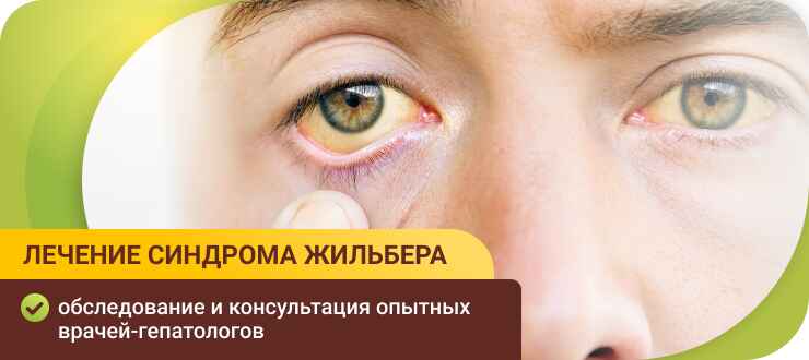 Лечение синдрома Жильбера