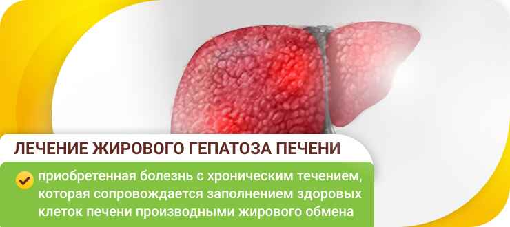 Лечение жирового гепатоза печени в клиники Лечение жирового гепатоза печени