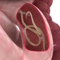 Гельминтозы