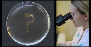 Диагностика на гельминтозов