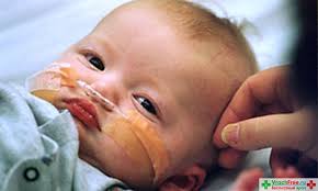 Симптомы первичного иммунодефицита