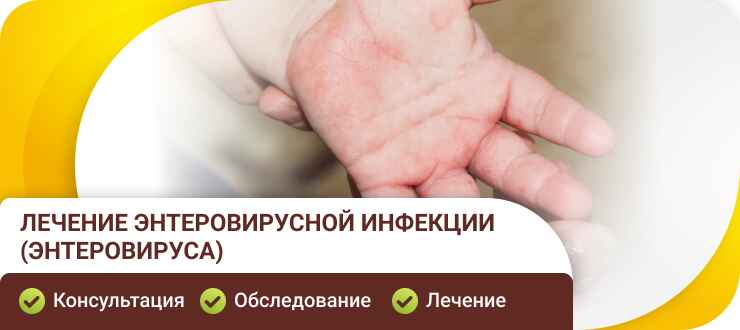 Лечение энтеровируса