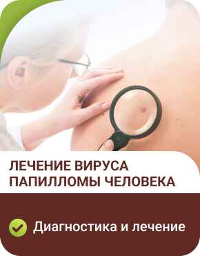 Лечение ВПЧ