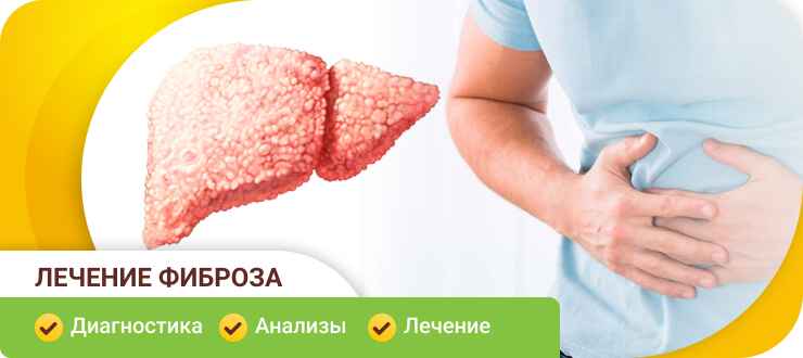 Лечение фиброза