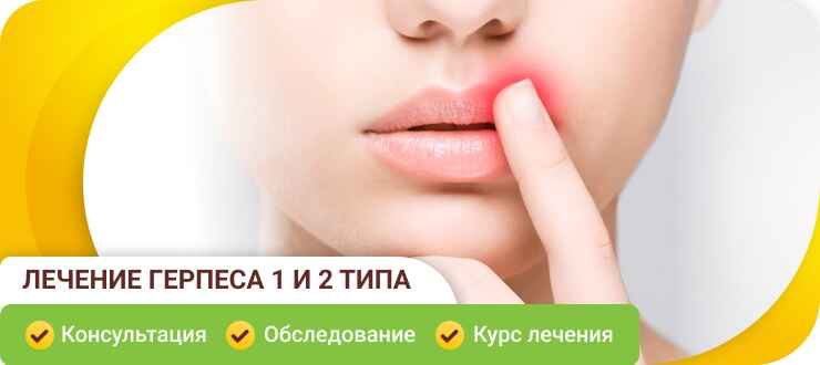 Лечение герпеса 1 и 2 типа