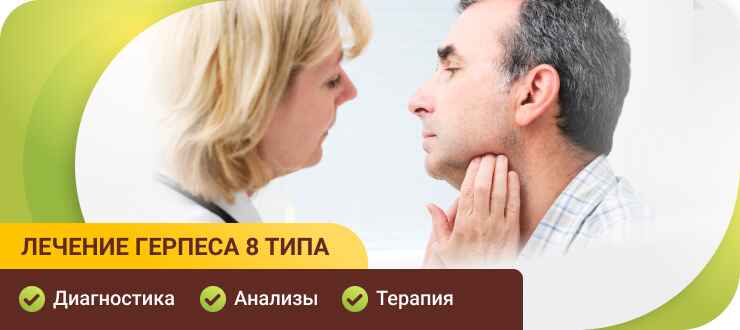 Лечение герпеса 8 типа