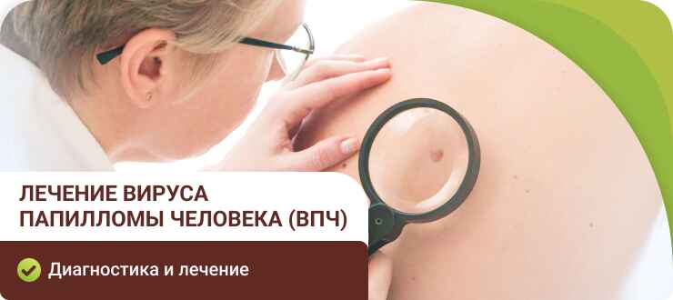 Лечение ВПЧ