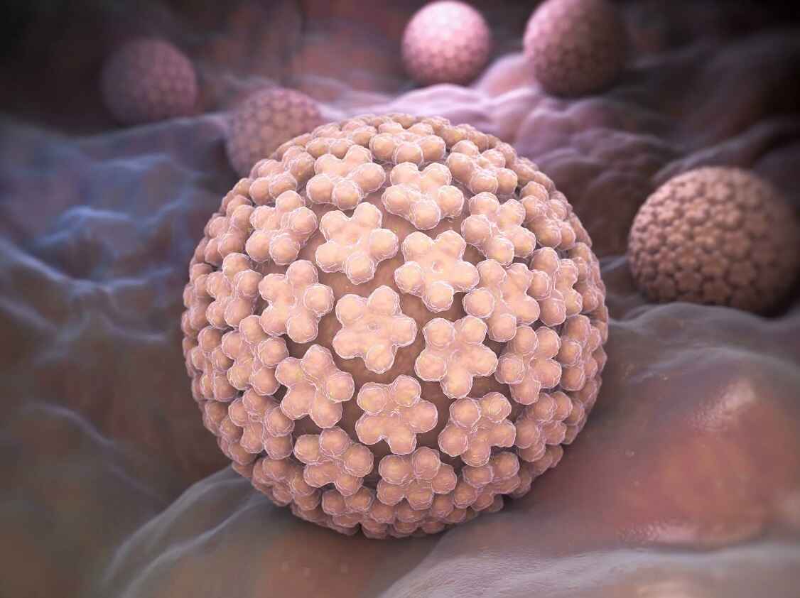 Лечение вируса папилломы человека