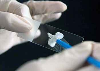 Диагностика гарднереллеза