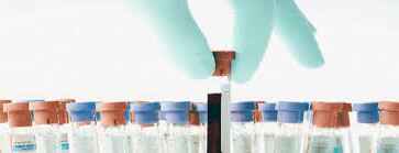 Анализ на вирус герпеса 7 типа 